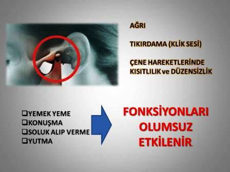 Çene Eklemi problemlerinde olumsuz etkilenen fonksiyonlar