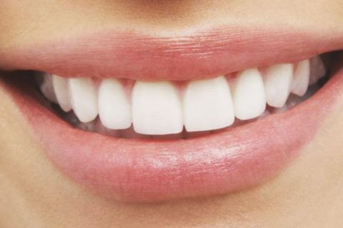 Diş beyazlatma teknikleri nelerdir ?