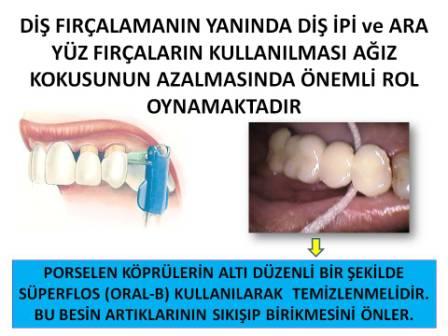 AĞIZ KOKUSU ENGELLEME
