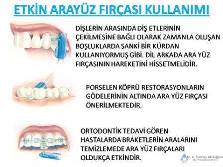 ara yüz fırçası kullanımı