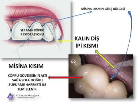 Oral B Süperflos Diş ipi