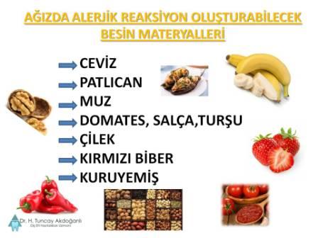 Ağızda alerji yapabilen besin maddeleri
