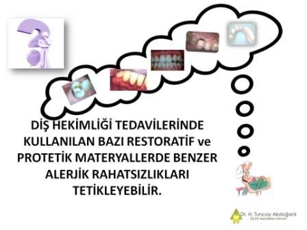 Ağız içi alerjik rahatsızlıklar