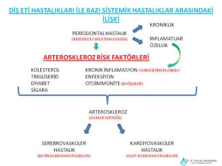 dişeti hastalıkları, damar sertliği oluşmasında bir etken olabilmektedir.