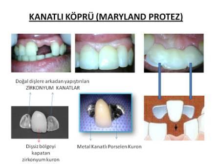 Kanatlı Köprü