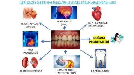 Diş eti hastalıkları ve genel sağlığımız