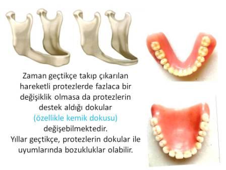 Zaman içinde ağız içinde meydana gelen değişiklikler