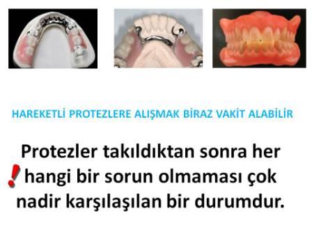 Hareketli protezlere alışmak