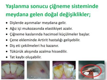 yaşlanma sonucu ağız içi değişiklikler