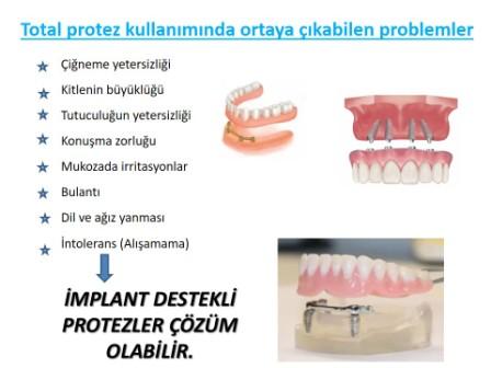 protez kullanımı sırasında ortaya çıkan problemler