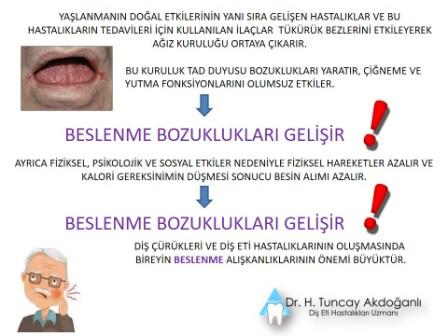 yaşlılarda beslenme bozukluğu