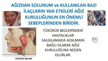 ağız kuruluğunu oluşturan etkenler