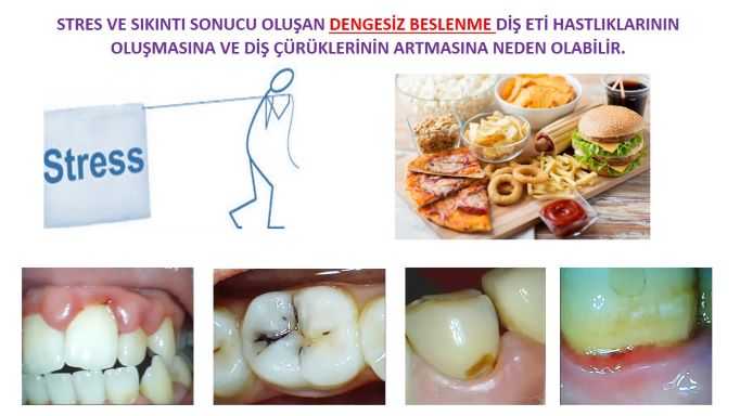 dengesiz beslenme sonucu ağız içi sorunlar