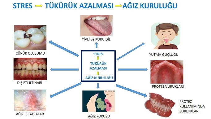 stresin neden olduğu ağız içi problemler