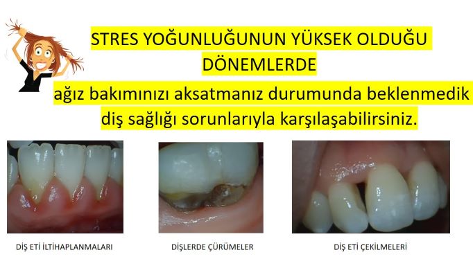 strese ağıza vurur mu?