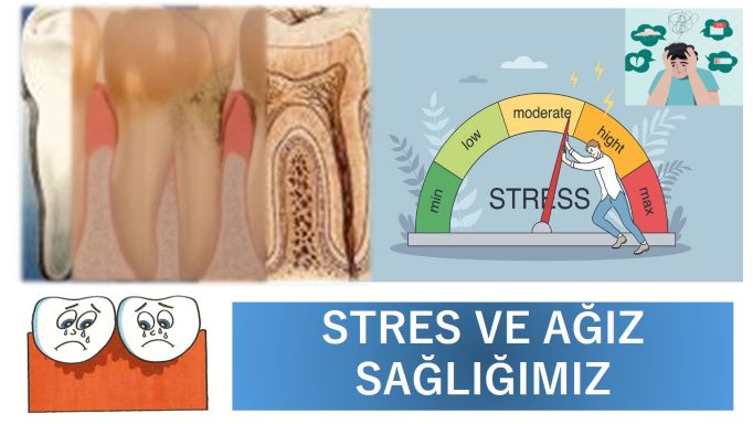 stresin ağız sağlığına olan etkileri