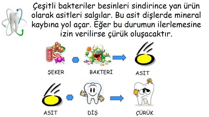 Diş çürükleri nasıl oluşur