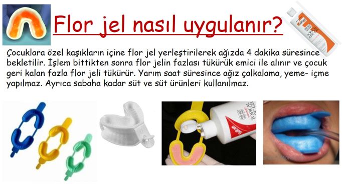 Florür nasıl uygulanır?