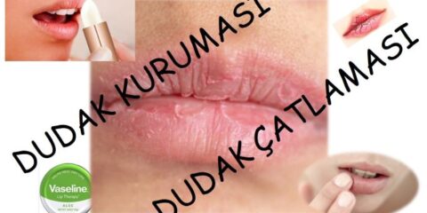 dudak kuruması neden olur