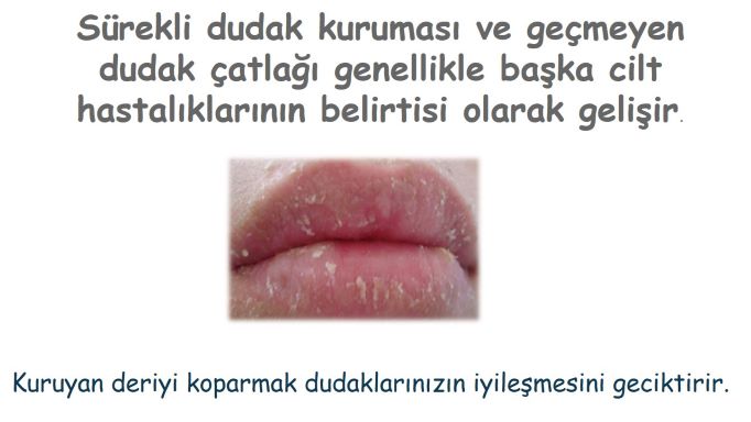 Dermatolojik dudak rahatsızlıkları