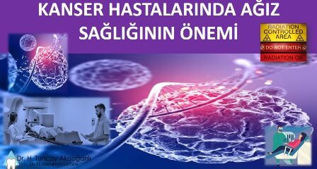 kanser tedavisinde ağız sağlığının önemi