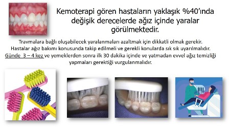 Kemaoterapi gören kanser  hastalarında ağız bakımı