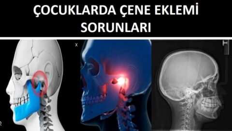 çocuklarda çene eklemi sorunları