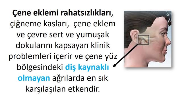 diş kaynaklı olmayan çene ağrıları