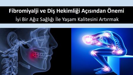 fibromiyalji ve diş hekimliğinde önemi