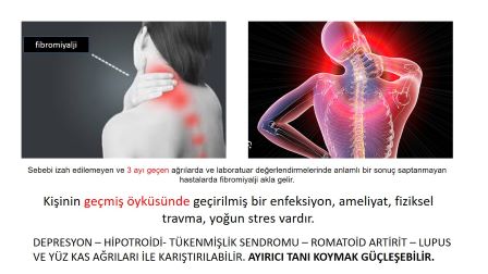 fibromiyalji çene ağrısı yapar mı ?