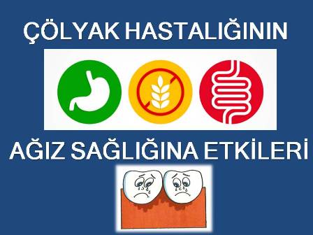 çölyak hastalığı