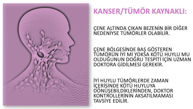kanser ve tümör kaynaklı şişlikler
