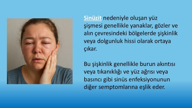 sinüzit hastalığı