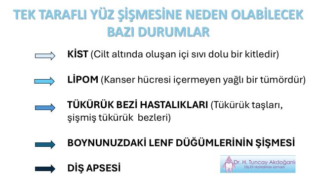 yüzde şişme nedenleri