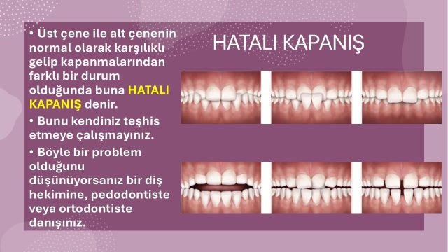 dişlerin hatalı kapanışlar