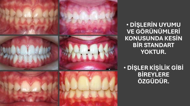 dişlerlerin kapanışı