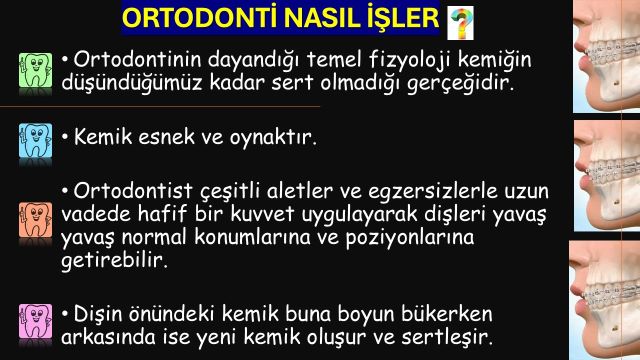 ortodonti nedir