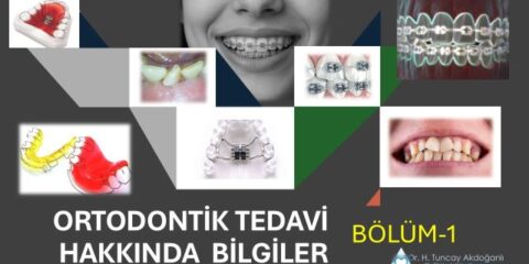 ortodontik tedavi hakkında bilgi