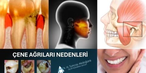 çene ağrısına neden olabilecek durumlar