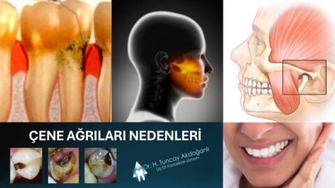 çene ağrısına neden olabilecek durumlar