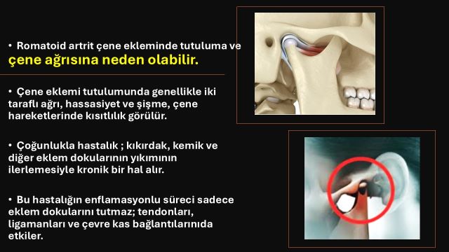 çene ekleminde ağrıya neden olabilecek durumlar