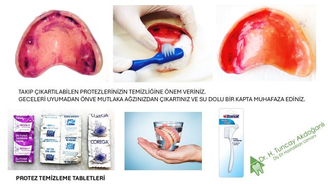 protez temizliğini anlatan bir görsel