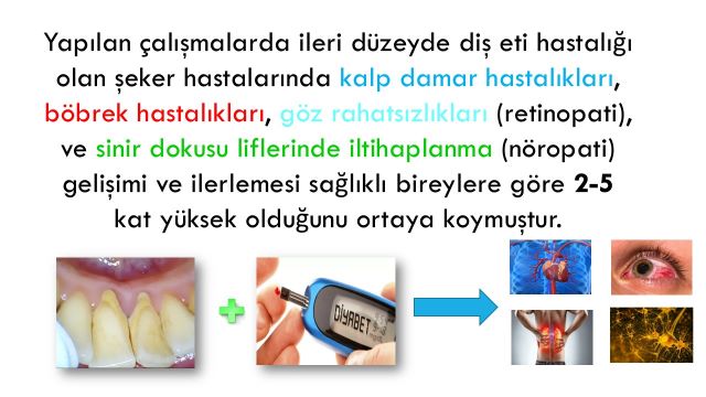 Diş ve diş eti hastalıklarına bağlı diğer organlarda görülebilecek rahatsızlıklar.