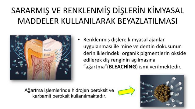 renklenmiş dişlerin tedavisinde kullanılan kimyasal maddeler