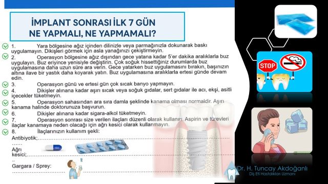 implant sonrası hastalara yapılan öneriler