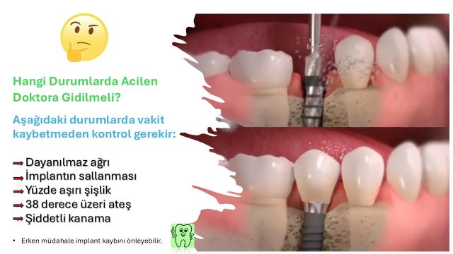 İmplant sonrası enfeksiyon belirtileri ve ateş yükselmesi