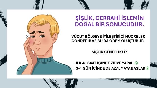 İmplant sonrası yanakta oluşan hafif şişlik ve ödem