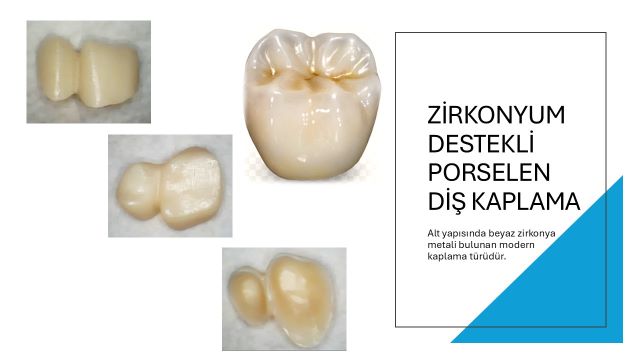 estetik diş kaplama gülüş tasarımı