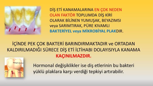 hormonal değişikliklere bağlı diş eti iltihabı