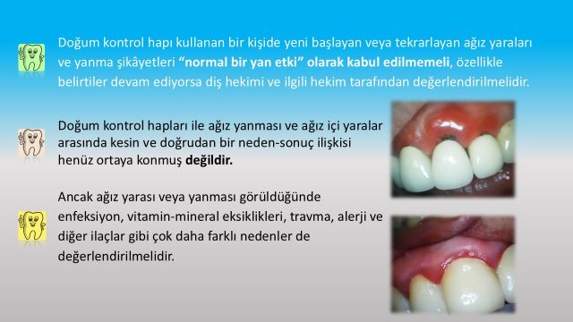 doğum kontrol hapı kullanımına bağlı ağız içinde rahatsızlık